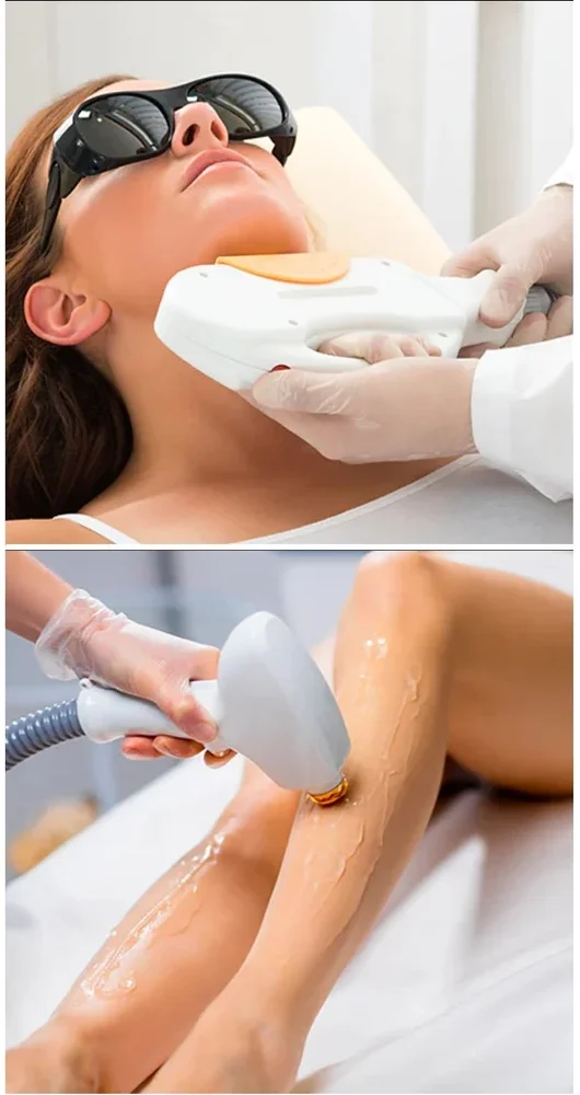 laser-hair-removal-service-1000×1000 laser-hair-removal-service-1000x1000