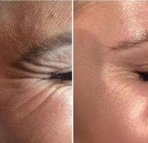 botok-before-after
